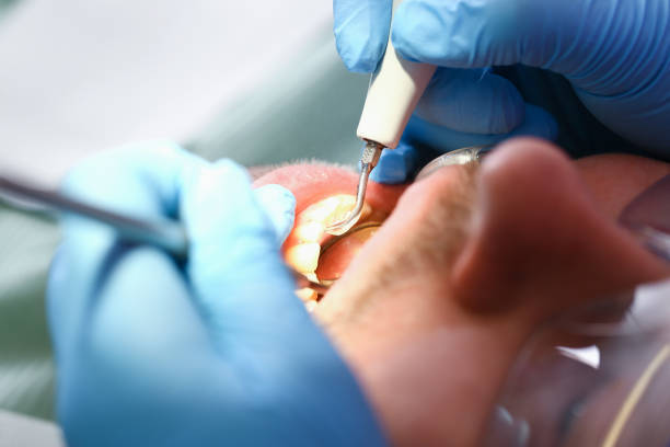 Best Pediatric Emergency Dentist in Normandy Park, WA